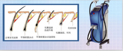 廣州脫毛儀器價格，脫毛一次多少錢，用什么儀器比較好？