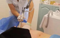 歐洲之星私密激光儀器多少錢(qián)一臺(tái)？歐洲之星價(jià)格_私密激光設(shè)備價(jià)格